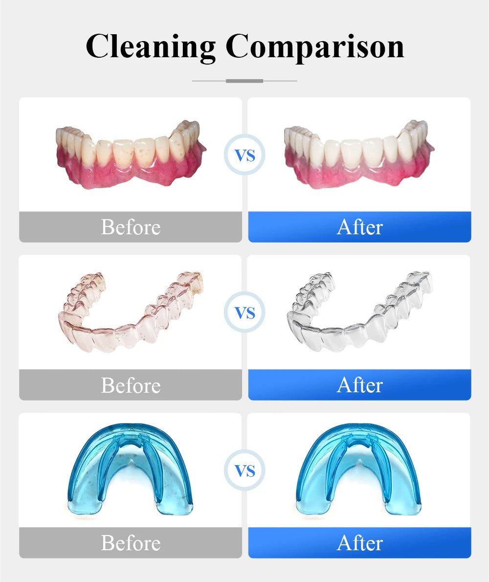 Tullker Household Ultrasonic Retainer Cleaner for Denture Jewelry Braces Cleaning with UV Light - Rtigos